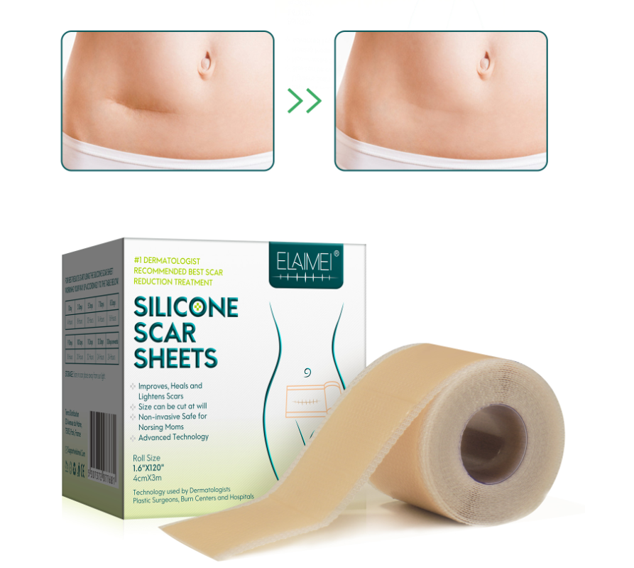 Silicone Scar Patch Removal